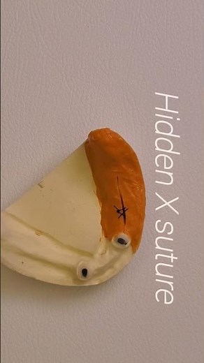 Figure 8 suture & Hidden X suture