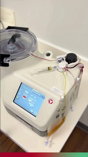 Platelet-Rich Plasma (PRP) Treatment