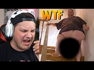 Man Has 80-lb Testicles - Reaction