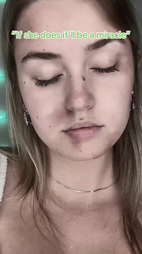 22K views · 689 reactions | #POV Your memory fades away… #memory #gone #crash | Celia Murphy | Facebook