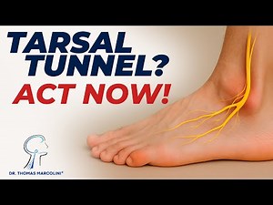 Tibial Nerve Treatment in Tarsal Tunnel Syndrome: How to Beat the Burning, Stabbing, and Foot Pain