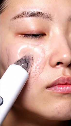 “You Won’t Believe This Extraction”