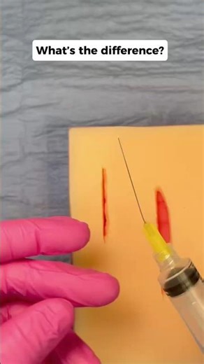 Same Drug, Different Risk 1% vs 2% Lidocaine 💉 #clinicalskills #medicaleducation #shorts