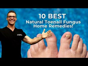 #1 BEST Toenail Fungus Treatment? [Top 10 Home Remedies] 2024