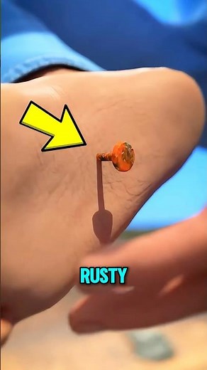 What Really Happens If You Step on a Rusty Nail? 😨