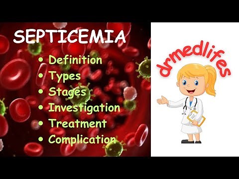 septicemia /sepsis types stages investigation treatment complications