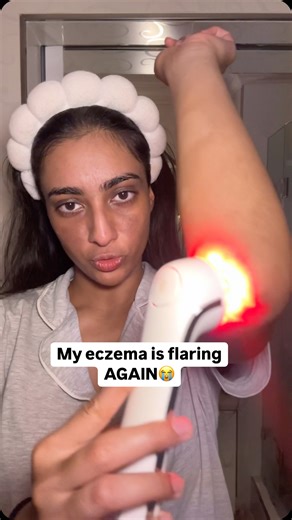 Shiv Sewlal | 🇿🇦 on Instagram: "What I’m doing for my elbow eczema⬇️ 1) Ice packs to help calm down the itchiness. As soon as I start feeling itchy, I try to use one. But I keep forgetting to put it back in the freezer so 5/10 it’s always melted🥲 2) Red light Therapy to reduce the inflammation and gradually lighten the scars. Their Festive Sale💃🏽 [Use this discount code: HAPPYHOLIDAYS60 for an extra $60 off🫶🏽] (search www.amareskin.com or click the link in my bio) 3) I’m supposed to be we