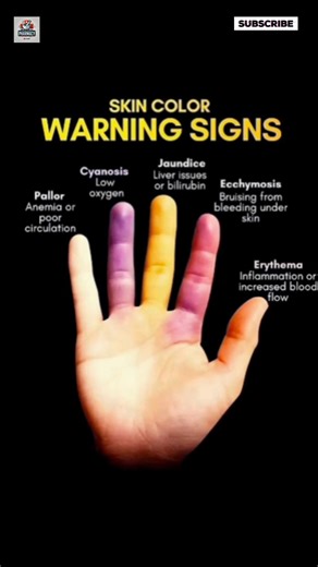 skin colour warning signs #anatomy #skin #skincareroutine