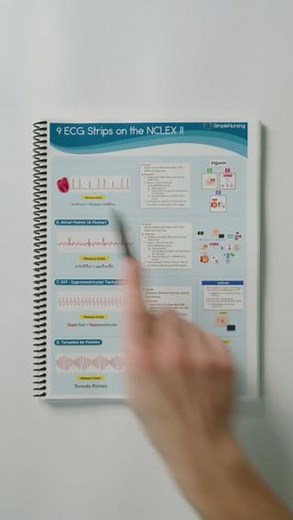 Nurse Mike from Simple Nursing on Instagram: "Save this for your NCLEX prep! . . . #ekg #ecg #nclex #nursingschool #studyguide"