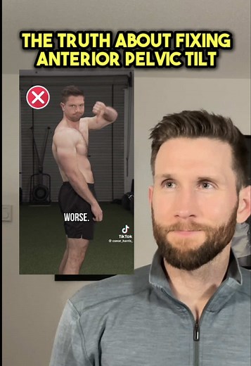 Fixing Anterior Pelvic Tilt: Simple, Practical Options