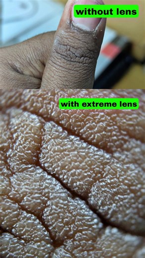 Extreme Macro Lens for Mobile Macro Photography - EM15 Extreme Macro Lens