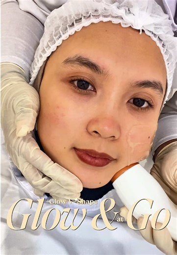 V-Shape look dalam waktu 30 menit? bisa banget dong kalau treatmentnya di Glow & Go🤗 super happy karena afternya kulit kerasa lebih cerah dan tirus tanpa downtime😍 📍Glow & Go PVJ Bandung #instantlifting #treatmentbandung #facialbandung