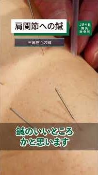 四十肩がつらい。でも鍼は怖そう…痛みを我慢する前に、知っておかないともったいない！【松山市・さきやま鍼灸接骨院】