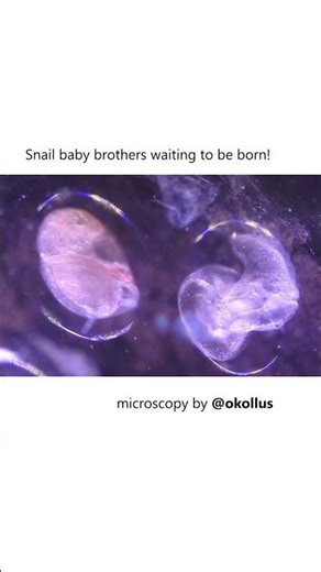 Baby snails waiting to be born! #microscopy #biology #science #nature
