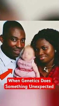 Black Parents Gave Birth to a White Baby