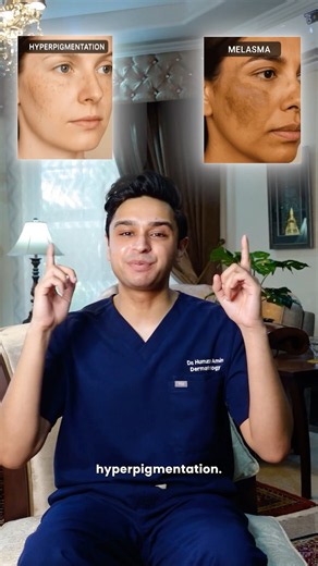 Melasma Or Hyperpigmentation? Which one do you have 🤔