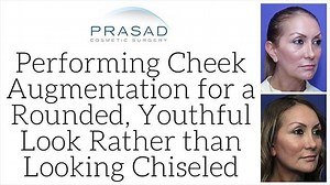 Why Fillers Should be Considered for Fuller, More Rounded Cheeks, Especially in Avoiding a Chiseled Look