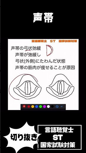 27-75 声帯の弓状弛緩 声帯結節 声帯嚢胞 声帯萎縮 喉頭肉芽腫 ポリープ様声帯 これらの特徴は？？