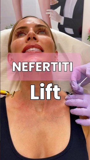 A Nefertiti lift using Botox! #botox #lift #necklines #nefertiti #aesthetics #medspa #antiaging