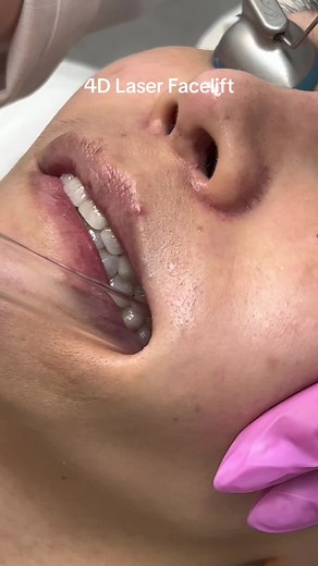 Elif benar on TikTok