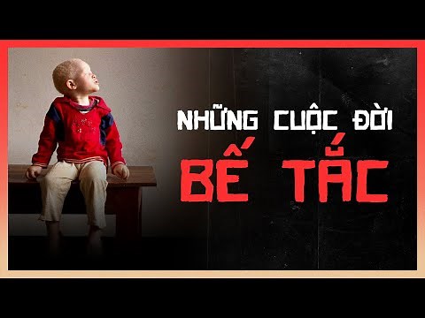 Vấn nạn SĂN LÙNG NGƯỜI BẠCH TẠNG tại CHÂU PHI