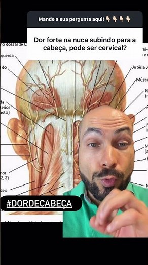 Dor na nuca subindo para a cabeça, pode ser coluna? #medicina #neurocirurgia #dordecabeca