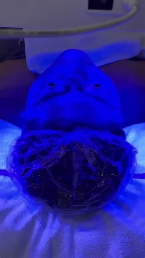 Extractions deep cleansing facial before after Silvia Ruano, Blushed Academy, Leyenda beauty bar ￼