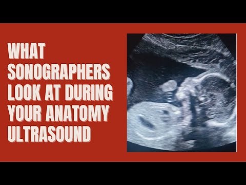 Inside the Anatomy Ultrasound: What We REALLY Check at 20 Weeks!