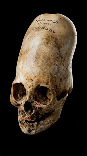 They Deformed Their Heads on Purpose...