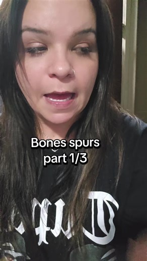 Understanding Bone Spurs in Dental Extractions