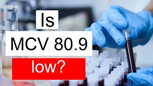 Is MCV 80.9 low, normal or dangerous? What does Mean corpuscular volume level 80.9 mean?