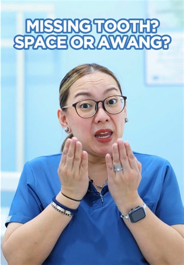 Solutions for Missing Teeth: Fixed Bridges and Implants