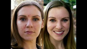 Proactiv TV Spot, 'Ready for Travel'