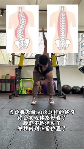Spinal alignment training#Scoliosis#Spinal health#Posture correction