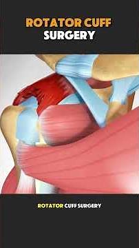 Rotator Cuff Surgery in 3D | Shoulder Repair Explained 😲 #anatomy #doctor