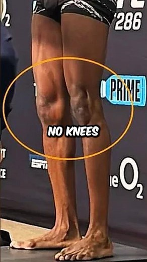 DC Reveals the Truth About Kamaru Usman’s Knees 😳🥊