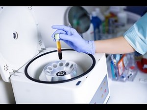 Centrifugation for blood Glucose test (Wear Gloves and lab coat always)