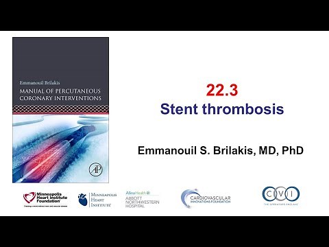22.3 Stent Thrombosis: Manual of PCI