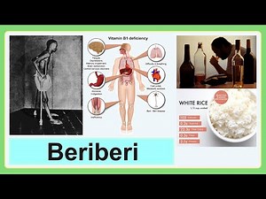 beriberi