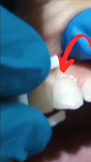 ⏳ Fil dentaire en 10 secondes fais le comme un pro !