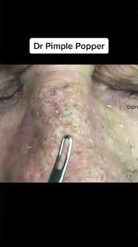 Nose Blackheads To Start Your Weekend #shorts