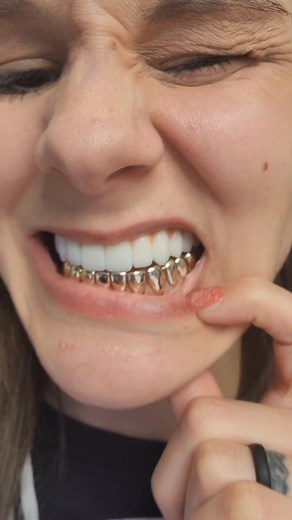 4 comments | Gold teeth aren’t “evil.” They’re actually one of the...