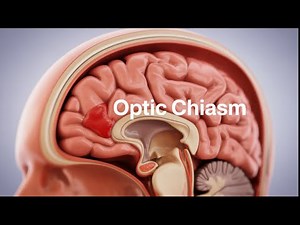 Optic Chiasm Relations👁️ | USMLE Step 1/2 CK