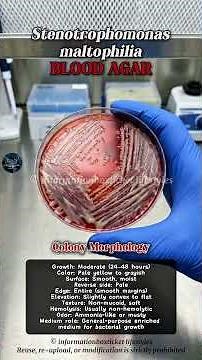 Stenotrophomonas maltophilia - Blood Agar | Colony Morphology & Lab Identification #bacteriaculture