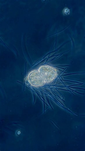 3K views · 953 reactions | From one to two. What you can see in this time-lapse video is the asexual reproduction of a ciliate through the process of mitosis and subsequent bipartition. . . . . #science #biology #cell #celldivision #mitosis #biologystudent | Science into Images | Facebook