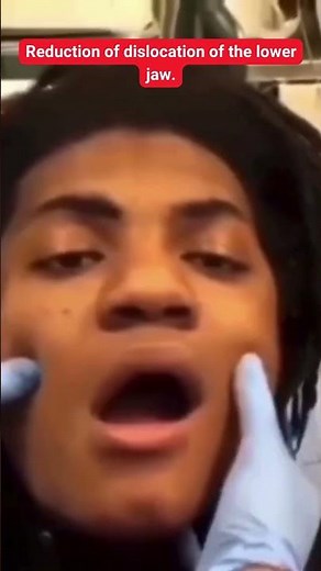 Reduction of dislocation of the lower jaw.