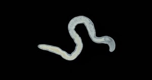 Video Stok Nemertea Worm Under Microscope Class Hoplonemertea (100% Tanpa Royalti) 1100136885 | Shutterstock