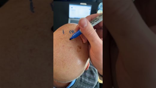 Miss you already baldy