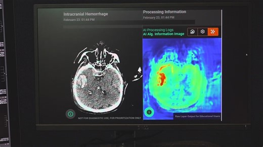 Mercy Hospital in Fort Smith speeds up diagnoses with AI-powered Aidoc