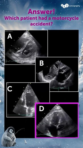 Did you spot the problem? Answer!